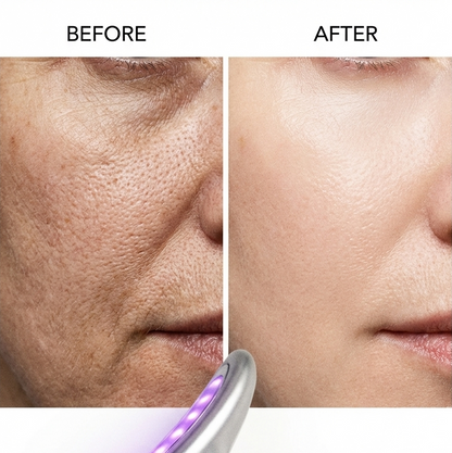 NurtureBeauty™ LED Light Therapy Wand